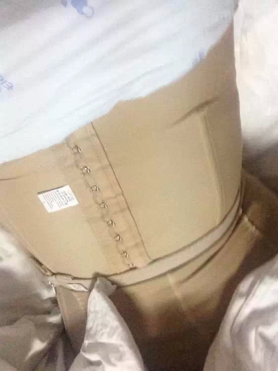 昆明吸脂最有名医生_昆明腰部吸脂价格多少_昆明吸脂手术