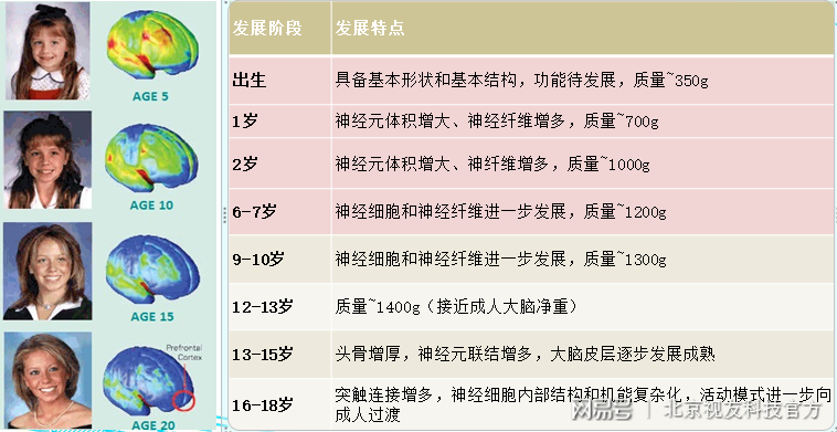 脑龄测试小游戏_脑龄测试瞬间记忆_脑龄测试