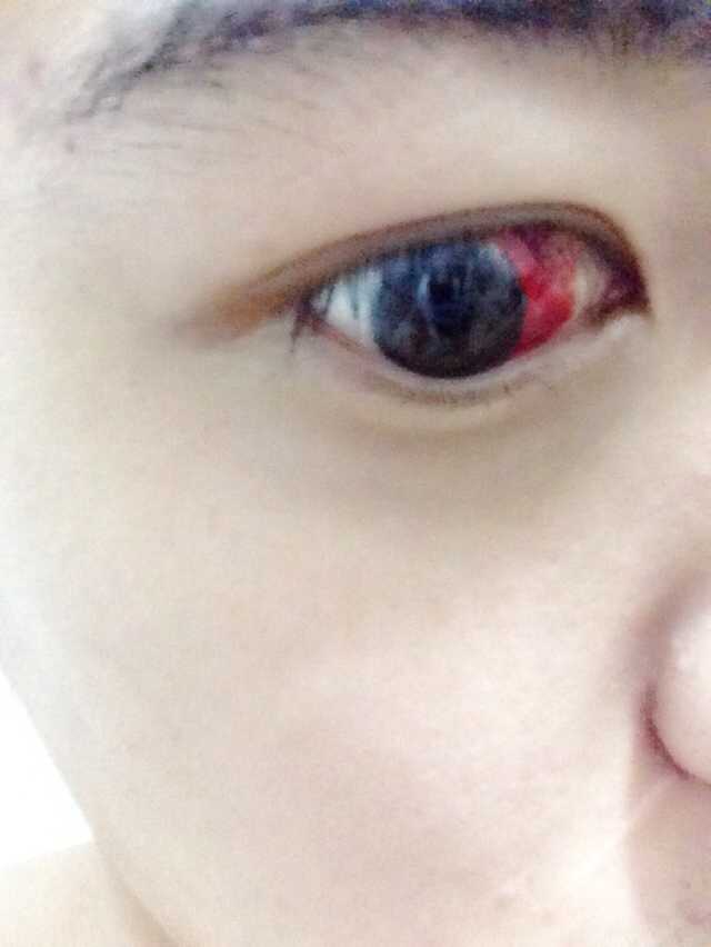 手机玩游戏多了眼睛充血_手机玩游戏多了眼睛充血_手机玩游戏多了眼睛充血