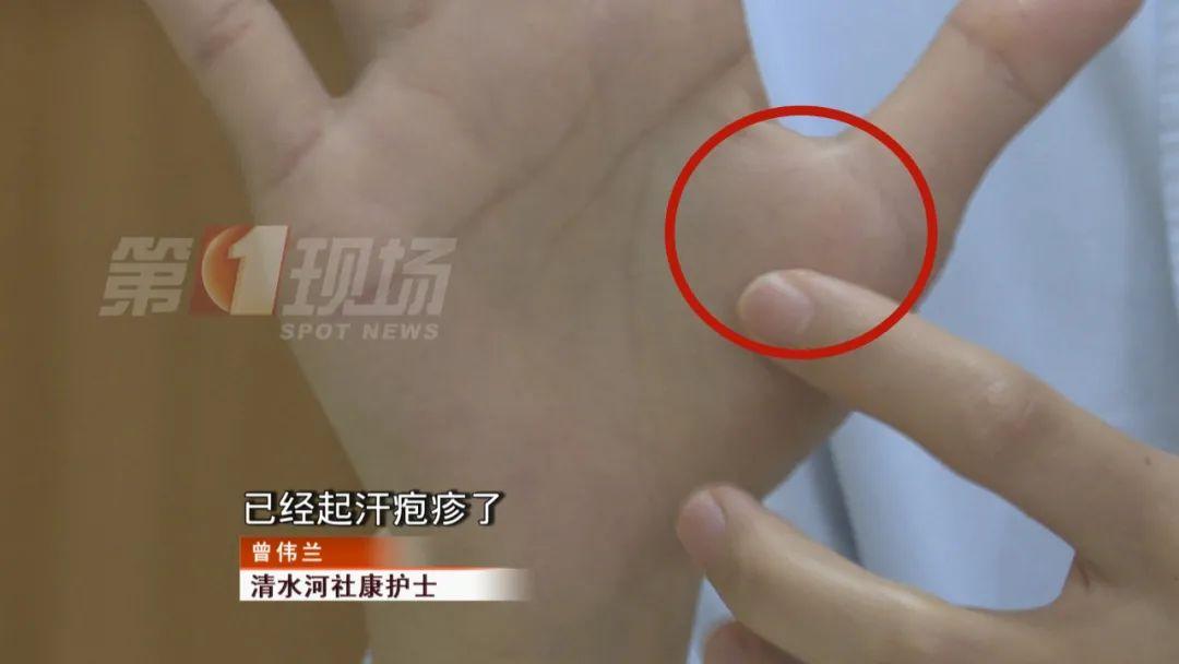 手机玩游戏时手指出汗_玩手机游戏手指头出汗怎么办_玩手机游戏手出汗怎样解决方法