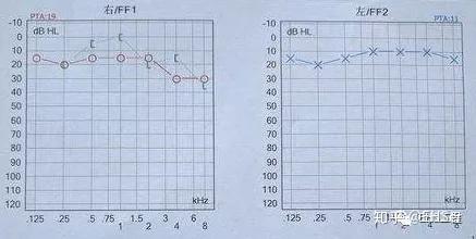 玩游戏你耳朵聋吗_手机游戏会导致耳聋吗_玩游戏会耳鸣吗